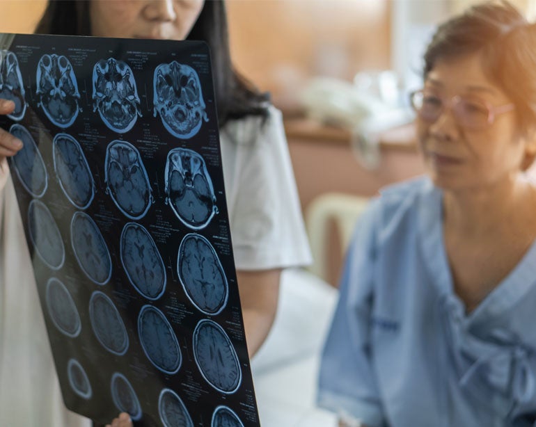 A doctor and a senior Asian woman are looking at their MRI results and considering options for her chronic condition.